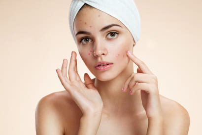 Acne Treatments medical services